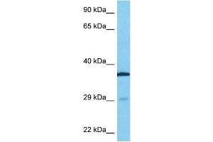 Host:  Rabbit  Target Name:  TTP  Sample Type:  Fetal Lung lysates  Antibody Dilution:  0. (ZFP36 Antikörper  (N-Term))