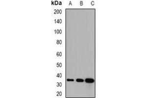Western blot analysis of GPD1 expression in mouse kidney (A), mouse skeletal muscle (B), rat liver (C) whole cell lysates.