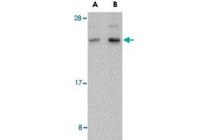 Western blot analysis of BANF1 in human kidney tissue lysate with BANF1 polyclonal antibody  at (A) 0. (BANF1 Antikörper  (C-Term))