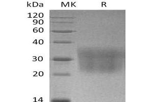 Western Blotting (WB) image for Chemokine (C-C Motif) Ligand 2 (CCL2) protein (His tag) (ABIN7320482) (CCL2 Protein (His tag))