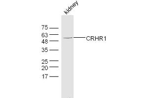Mouse kidney lysates probed with CRHR1 Polyclonal Antibody, Unconjugated  at 1:300 dilution and 4˚C overnight incubation. (CRHR1 Antikörper  (AA 55-150))