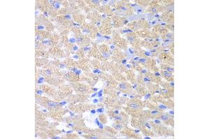 Immunohistochemistry of paraffin-embedded mouse heart using GPAM antibody at dilution of 1:100 (x40 lens). (GPAM Antikörper)