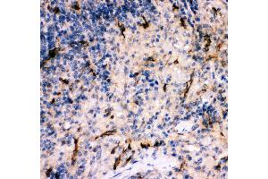 Anti- C5A antibody, IHC(P) IHC(P): Rat Spleen Tissue (C5 Antikörper  (AA 1-77))