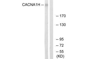 Western blot analysis of extracts from A549 cells, using CACNA1H antibody.