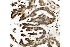 IHC analysis of TXNIP using anti-TXNIP antibody (ABIN7601882). (TXNIP Antikörper  (AA 5-391))