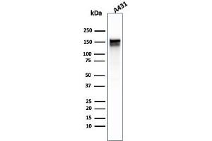 Western Blot Analysis of A431 cell lysate using EGFR Mouse Monoclonal Antibody (GFR/1667). (EGFR Antikörper)