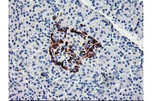 Immunohistochemical staining of paraffin-embedded Human pancreas tissue using anti-ACSS2 mouse monoclonal antibody. (ACSS2 Antikörper)