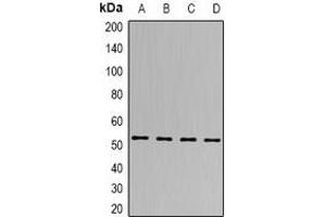 Western blot analysis of SEN2 expression in Hela (A), A549 (B), mouse brain (C), rat heart (D) whole cell lysates. (TSEN2 Antikörper)