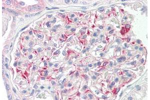 Image no. 3 for anti-STE20-Like Kinase (SLK) (AA 1151-1200) antibody (ABIN2879164) (SLK Antikörper  (AA 1151-1200))