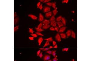 Immunofluorescence analysis of U2OS cells using TMOD4 Polyclonal Antibody (Tropomodulin 4 Antikörper)