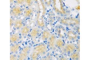 Immunohistochemistry of paraffin-embedded Mouse kidney using CYP4A11 Polyclonal Antibody at dilution of 1:100 (40x lens).