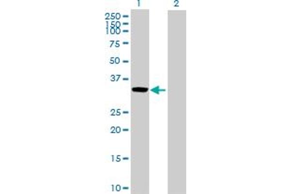 CCL27 Antikörper  (AA 1-112)