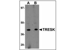 Western blot analysis of TRESK in rat brain tissue lysate with TRESK antibody at (A) 1 and (B) 2 µg/ml. (KCNK18 Antikörper)