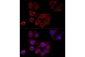 Immunofluorescence analysis of HeLa cells using CSF2RA antibody (ABIN3017509, ABIN3017510, ABIN3017511 and ABIN6220125) at dilution of 1:100 (40x lens). (CSF2RA Antikörper  (AA 23-150))