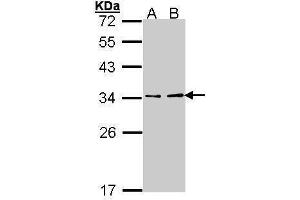 WB Image Sample (30 ug of whole cell lysate) A: Hep G2 , B: Molt-4 , 12% SDS PAGE antibody diluted at 1:1000 (ATP6V1E1 Antikörper  (Center))