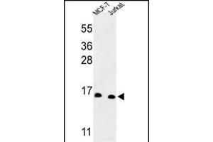 SNRPD3 Antikörper  (C-Term)