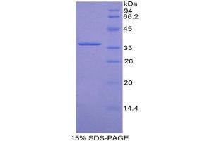 SDS-PAGE (SDS) image for Cyclin-Dependent Kinase 4 (CDK4) (AA 6-295) protein (His tag) (ABIN1879265) (CDK4 Protein (AA 6-295) (His tag))