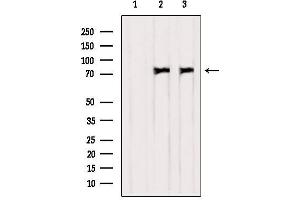 Western blot analysis of extracts from various samples, using PKC delta Antibody. (PKC delta Antikörper)