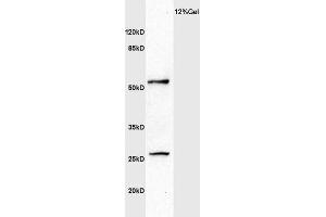 Human colon carcinoma lysate probed with Anti MMP1 Polyclonal Antibody, Unconjugated  at 1:3000 for 90 min at 37˚C. (MMP1 Antikörper  (AA 401-469))