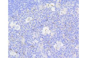Immunohistochemistry (IHC) image for anti-Caspase 3 (CASP3) antibody (ABIN4903137)