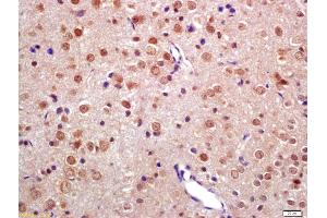 Formalin-fixed and paraffin embedded rat brain labeled with Anti-TNIP2 Polyclonal Antibody, Unconjugated (ABIN872901) at 1:200 followed by conjugation to the secondary antibody and DAB staining (TNIP2 Antikörper  (AA 85-180))