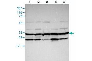 Western blot analysis of Lane 1: RT-4, Lane 2: EFO-21, Lane 3: U-138 MG, Lane 4: Liver, Lane 5: Tonsil with PSMA3 polyclonal antibody . (PSMA3 Antikörper)