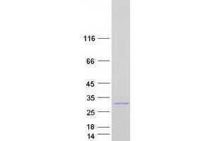 Validation with Western Blot (STARD4 Protein (Myc-DYKDDDDK Tag))