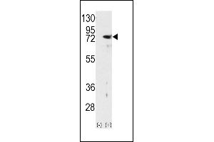 Western blot analysis of PKC delta (arrow) using rabbit polyclonal PKC delta Antibody (N-term) (ABIN391006 and ABIN2841179). (PKC delta Antikörper  (N-Term))