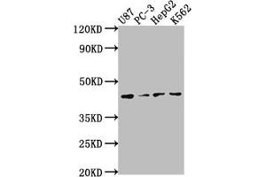 Western Blot Positive WB detected in: U87 whole cell lysate, PC-3 whole cell lysate, HepG2 whole cell lysate, K562 whole cell lysate All lanes: OPCML antibody at 1:2000 Secondary Goat polyclonal to rabbit IgG at 1/50000 dilution Predicted band size: 39, 38, 34 kDa Observed band size: 39 kDa