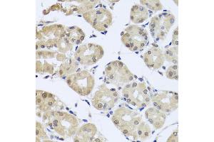 Immunohistochemistry of paraffin-embedded human stomach using cdc45 antibody (ABIN5971079) at dilution of 1/100 (40x lens). (CDC45 Antikörper)