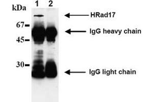 Western Blotting (WB) image for anti-RAD17 (RAD17) antibody (ABIN492574) (RAD17 Antikörper)
