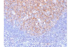 Formalin-fixed, paraffin-embedded human Tonsil stained with CD81 Mouse Monoclonal Antibody (1. (CD81 Antikörper)