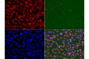 Immunofluorescence analysis of U2OS cell using RAD9A antibody. (RAD9A Antikörper)