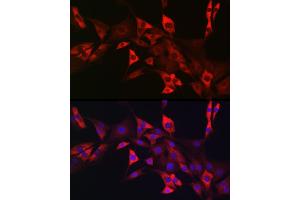 Immunofluorescence analysis of NIH/3T3 cells using CD117/c-Kit antibody (ABIN6133454, ABIN6142896, ABIN6142898 and ABIN6213818) at dilution of 1:50. (KIT Antikörper  (AA 25-295))