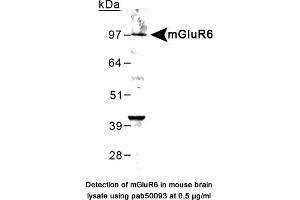 Image no. 1 for anti-Glutamate Receptor, Metabotropic 6 (GRM6) (C-Term) antibody (ABIN363402) (Metabotropic Glutamate Receptor 6 Antikörper  (C-Term))