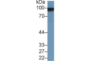 Western Blot; Sample: Rat Uterus lysate; Primary Ab: 1µg/ml Rabbit Anti-Rat MCAM Antibody Second Ab: 0. (MCAM Antikörper  (AA 323-560))
