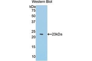 Western blot analysis of the recombinant protein. (IFNA Antikörper  (AA 1-187))