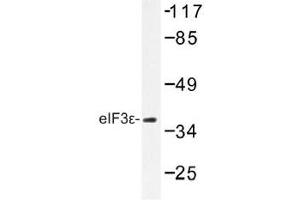 Image no. 1 for anti-Eukaryotic Translation Initiation Factor 3 Subunit E (EIF3E) antibody (ABIN317905) (EIF3E Antikörper)