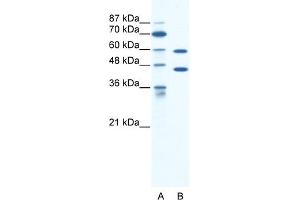 WB Suggested Anti-CATSPER2 Antibody Titration:  1. (CATSPER2 Antikörper  (C-Term))