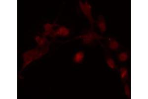 ABIN6274240 staining COLO205 cells by IF/ICC. (HOXD12 Antikörper  (Internal Region))