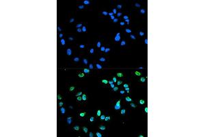Immunofluorescence analysis of HeLa cell using IRF5 antibody.
