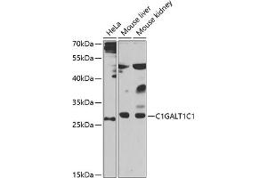 Western blot analysis of extracts of various cell lines, using C1GC1 antibody (ABIN6131024, ABIN6137748, ABIN6137749 and ABIN6223501) at 1:1000 dilution. (C1GALT1C1 Antikörper  (AA 30-190))