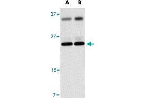 Western blot analysis of THEM4 in human liver tissue lysate with THEM4 polyclonal antibody  at (A) 1 and (B) 2 ug/mL .