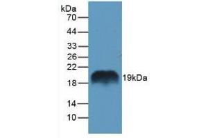 Figure. (REG1A Antikörper  (AA 10-165))