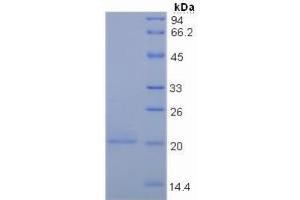 SDS-PAGE of Protein Standard from the Kit (Highly purified E. (MUC5AC ELISA Kit)