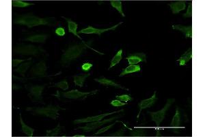 Immunofluorescence of monoclonal antibody to HTT on HeLa cell. (Huntingtin Antikörper  (AA 1524-1627))
