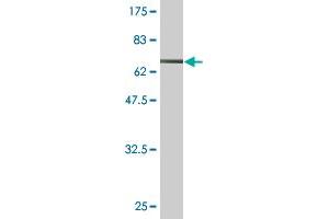 Western Blot detection against Immunogen (73. (ENO1 Antikörper  (AA 1-434))