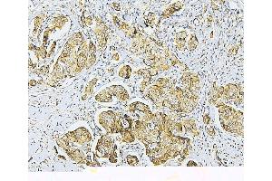 IHC analysis of NF2 using anti-NF2 antibody (ABIN7600115). (Merlin Antikörper  (AA 15-565))