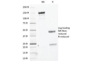 SDS-PAGE Analysis of Purified, BSA-Free Basic Cytokeratin Antibody (clone KRTH/1076). (Keratin Basic Antikörper)