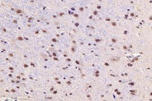 Immunohistochemistry analysis of paraffin-embedded ratsubstantia nigrausing PARC (ABIN7073606) at dilution of 1:1200 (CUL9 Antikörper)